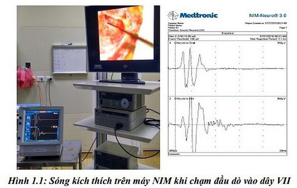 Nghiên cứu áp dụng kỹ thuật sinh học phân tử và chẩn đoán hình ảnh để nâng cao chất lượng chẩn đoán, điều trị điếc bẩm sinh ở trẻ em bằng cấy ốc tai điện tử