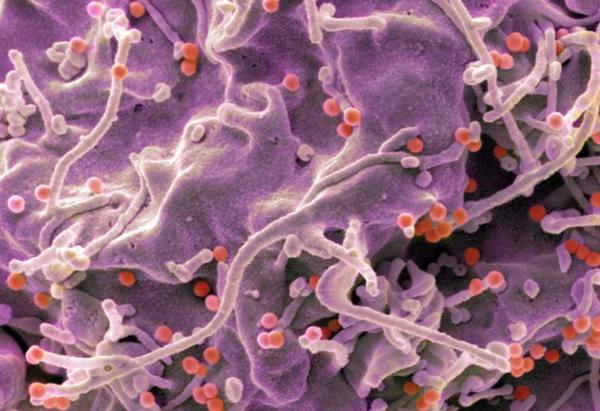 Vắc-xin HIV công nghệ mRNA kích hoạt phản ứng miễn dịch mạnh ở người