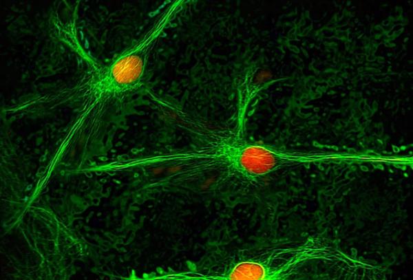 Phát hiện vùng não liên quan đến các cơn đau mãn tính