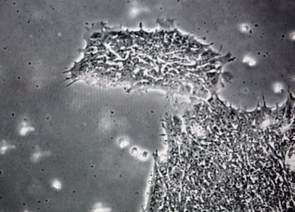 Phát hiện virus khiến con người bị ngớ ngẩn